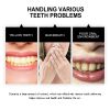 Oralhoe Teeth Powder, Teeth beauty teeth cleaning tartar teeth yellow smoke teeth care for the mouth